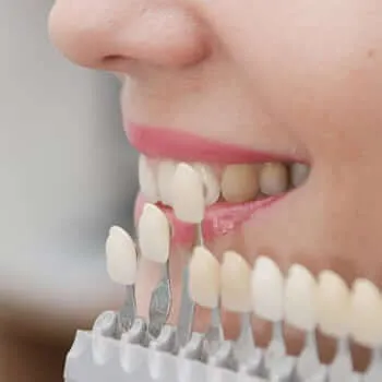 Dental crowns and bridges at our dental clinic in Roanoke, VA