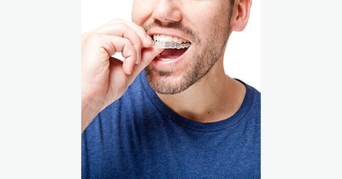 Invisalign vs. Braces: How to Choose the Best Option