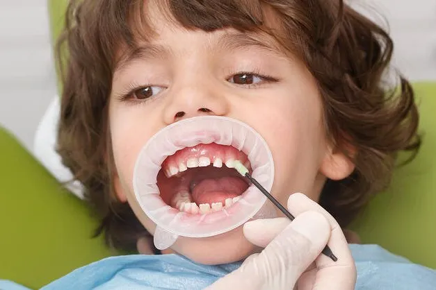 Dentist Near Penn Forest in Roanoke, VA - Mill Mountain Dentistry By Opulent Dental