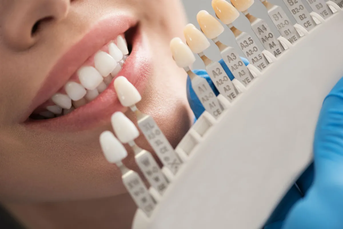 Fixed Implant Dentures Near Cave Spring, VA - Mill Mountain Dentistry By Opulent Dental