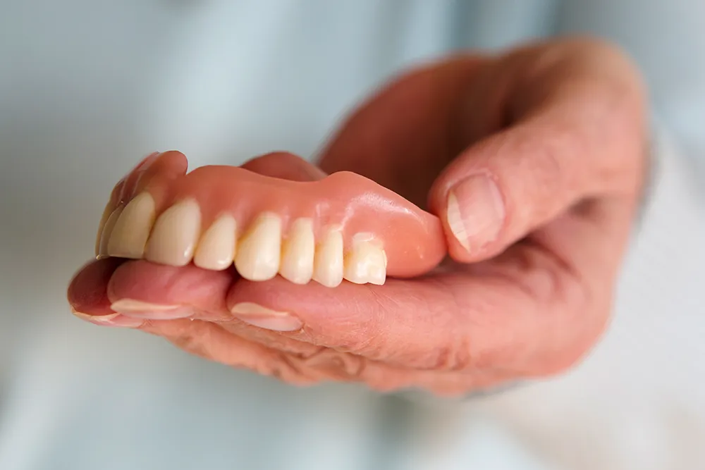 Fixed Implant Dentures Near Vinton, VA - Mill Mountain Dentistry By Opulent Dental