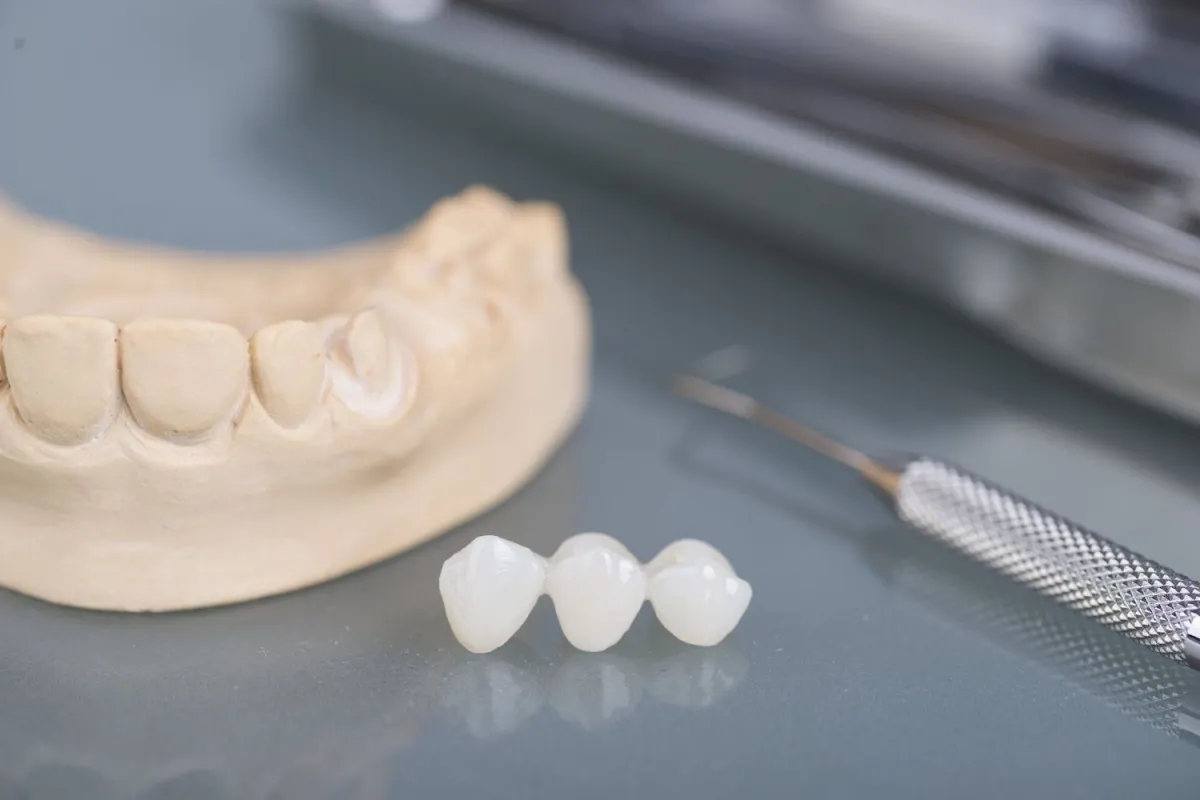 Full-Arch Restoration Near Cave Spring, VA - Mill Mountain Dentistry By Opulent Dental
